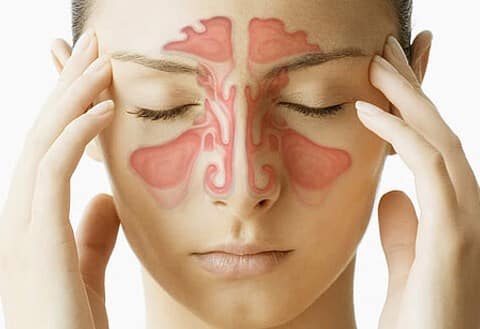 Sinus Surgery