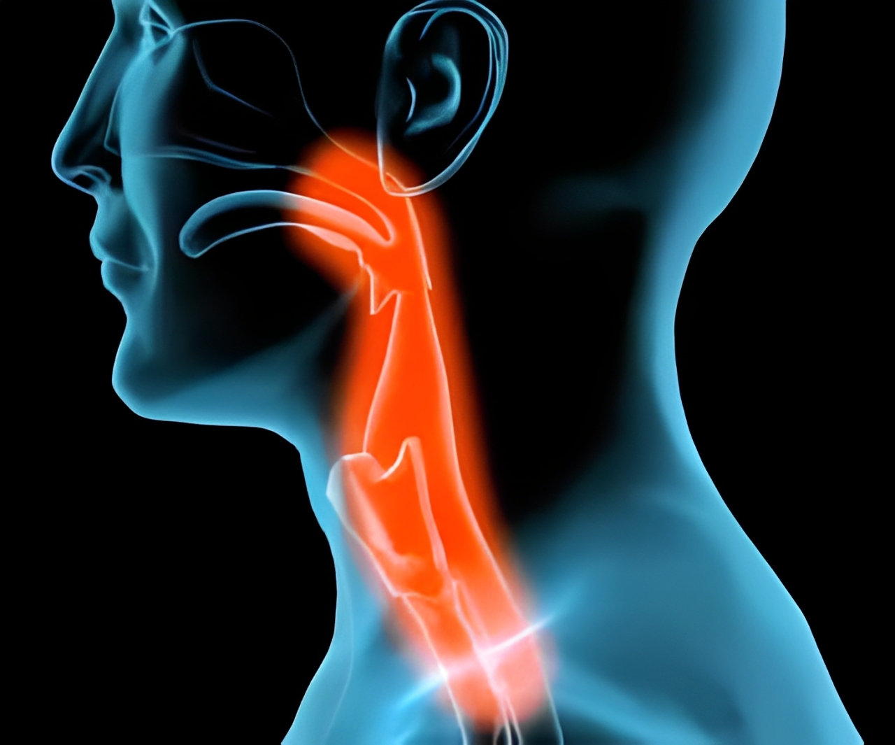 headneck (1)